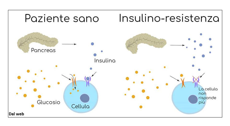 metabolismo paziente sano e paziente con insulino reststenza